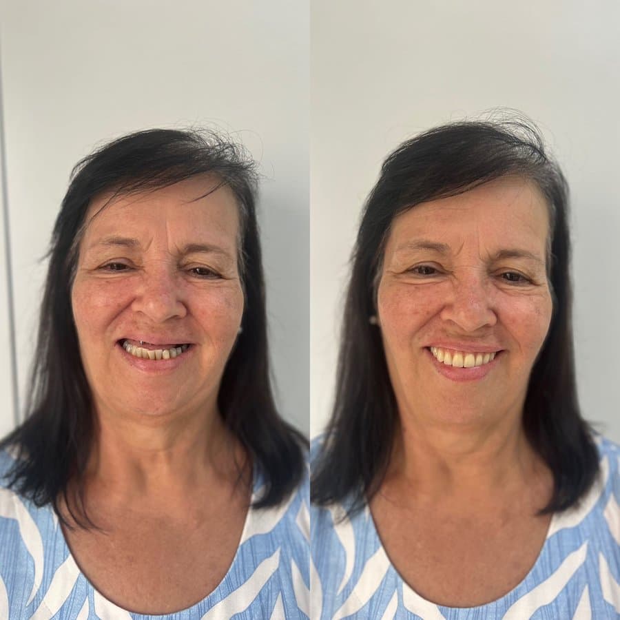 Caso 1: antes e depois do tratamento, lado a lado