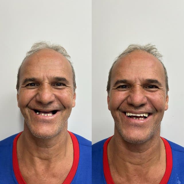 Caso 2: antes e depois do tratamento, lado a lado