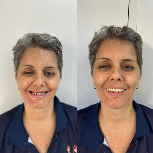 Caso 3: antes e depois do tratamento, lado a lado