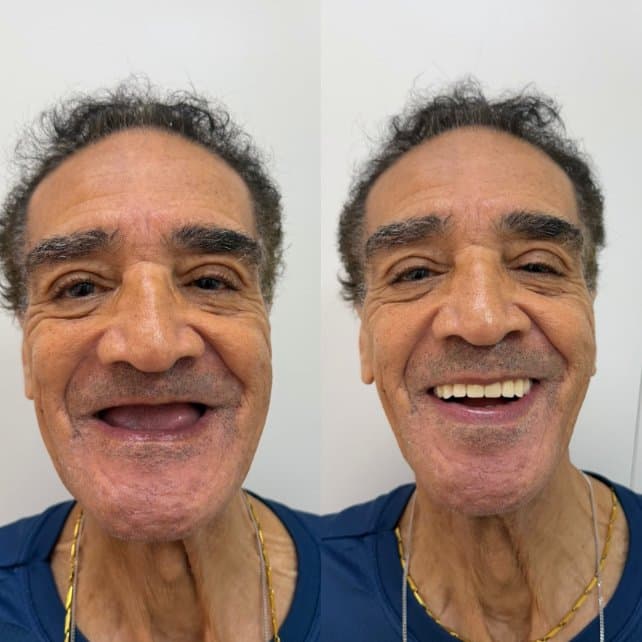 Caso 4: antes e depois do tratamento, lado a lado