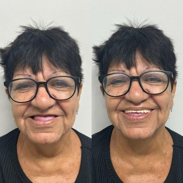 Caso 5: antes e depois do tratamento, lado a lado