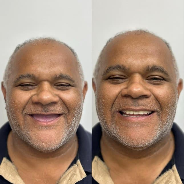 Caso 6: antes e depois do tratamento, lado a lado