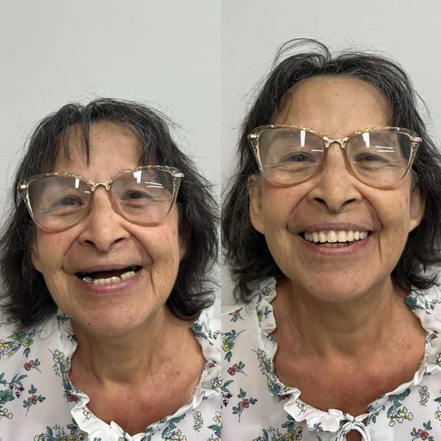 Caso 7: antes e depois do tratamento, lado a lado
